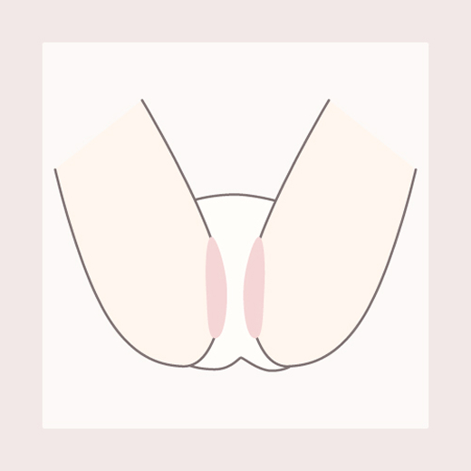女性 Iライン