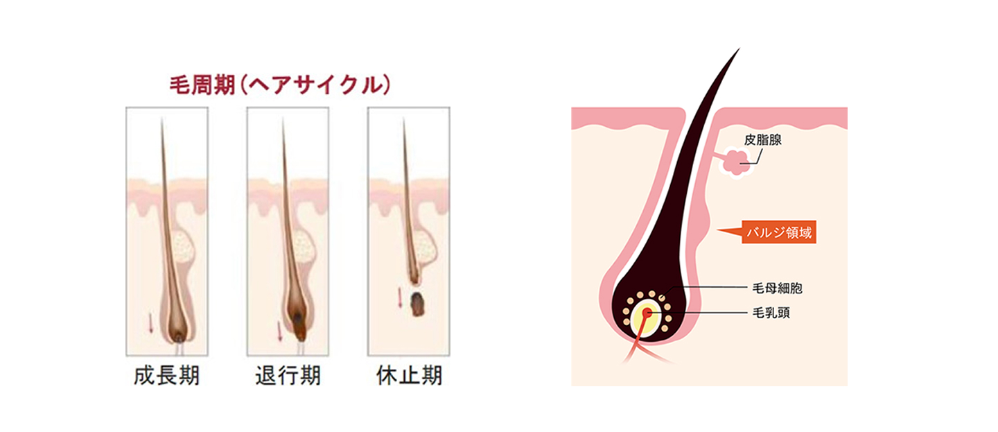 医療レーザー脱毛のメカニズム